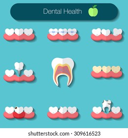 Dental care flat design Vector illustration of healthy teeth, caries, braces system, implantation, and other dental health icons set