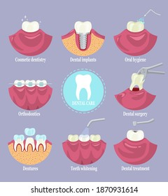 Dental care set, flat vector isolated illustration. Types of dentist clinic services. Cosmetic dentistry, dentures, orthodontics, teeth whitening, dental surgery, treatment and implants, oral hygiene.