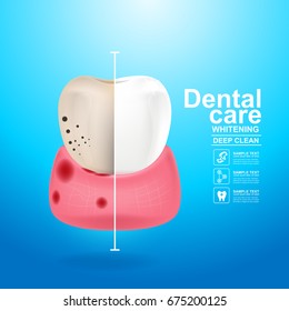 Dental Care and Teeth on Background Vector Concept.