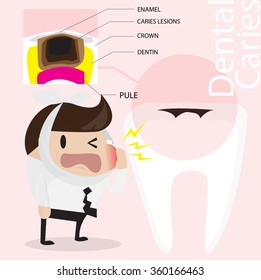 Dental caries vector cartoon