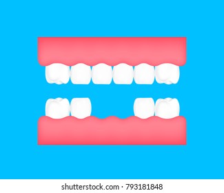 Dental cartoon of missing tooth. Dental care concept. Illustration isolated on blue background.