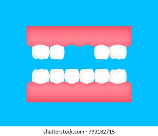 Dental cartoon of missing tooth. Dental care concept. Illustration isolated on blue background.