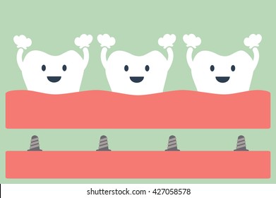 dental cartoon vector, cosmetic implant