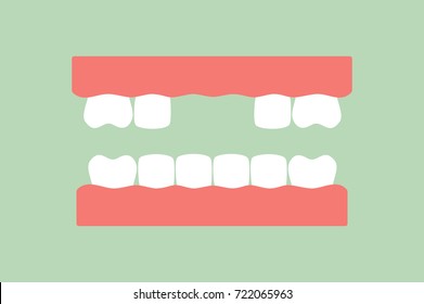 dental cartoon vector flat style for design, missing tooth