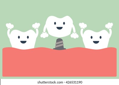 dental cartoon vector, dental implant with crown