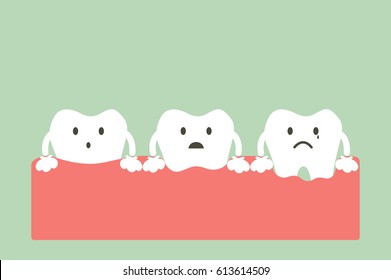 dental cartoon vector, step of gum disease - healthy teeth, gingivitis and periodontitis