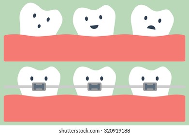 dental cartoon vector, teeth orthodontics