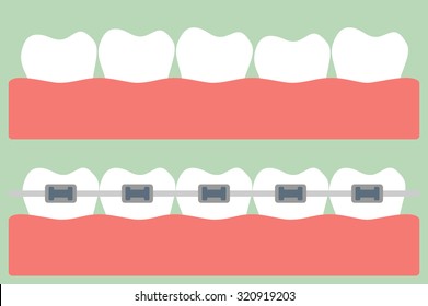 dental cartoon vector, teeth orthodontics