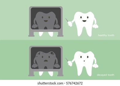 dental cartoon vector, tooth dentist x-ray healthy and unhealthy teeth