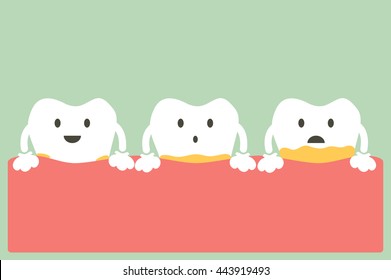 Dental Cartoon Vector, Tooth Periodontal Disease With Plaque Or Tartar