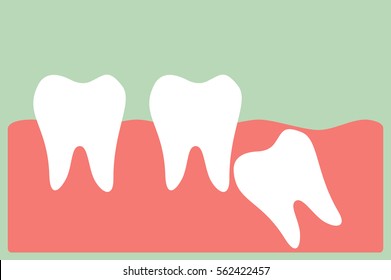 dental cartoon vector, wisdom tooth