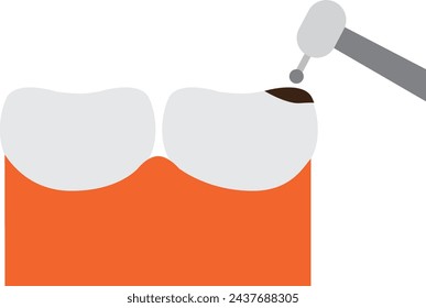 Concepto de cavidad dental.. Dientes sanos sonrientes con caricatura de dientes de caries triste en diseño plano