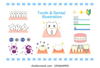 Dental character set implant periodontal disease, etc.