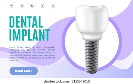 Dental clinic poster vector illustration. Advertising of hospital for teeth treatment. Medical services for installation of dental implant. Human gum with healthy teeth and denture on dentistry banner