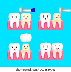Dental crown installation process. Cute cartoon tooth character. Dental care concept. Illustration isolated on blue background.