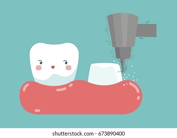 Dental crown installation process , tooth and teeth of dental concept