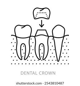 Dental crown, line icon. Installation scheme and anatomy of an artificial tooth. Dentistry and teeth restoration topic. Stomatology concept. Linear illustration, editable stroke icon