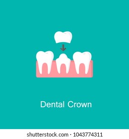 Dental crown, tooth treatment icon. Tooth prosthesis sign. Medicine symbol for info graphics, websites and print media. Vector flat icon.