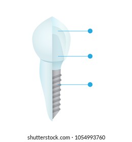 Dental crowns and implantation prosthodontics elements and tools. Template for your design. Vector flat illustration.