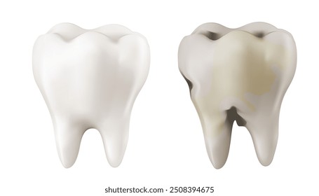 Dentistas dentários tratar dentes decaimento dentes decaimento dentes conceito de tratamento. remover placa, tratar dentes decaimento. aplicativos médicos, sites e hospital. Oscilações de gradiente de malha 3D.
