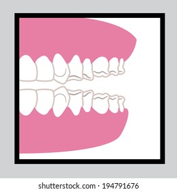 Dental design over gray background, vector illustration