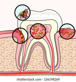 Enfermedades dentales