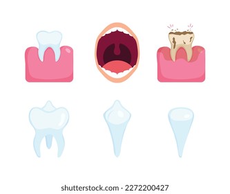 Dental diseases set. Teeth problems, different injuries. Infographics in dentistry Collection set. Healthy gums and teeth,Open mouth with teeth and tongue,Teeth and gums problems different injuries