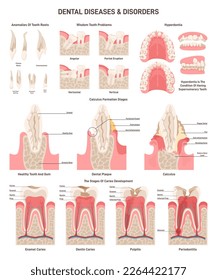 Dental disorders set. Oral cavity and human teeth diseases. Gums problem and tooth roots pathology. Dentist infographic banner or poster. Flat vector illustration