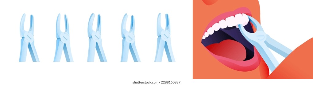 Dental Extracting Forceps Set. Cropped Beautiful Female Face White Teeth with Extracting Forceps Close Up. Modern Flat Vector Illustration.