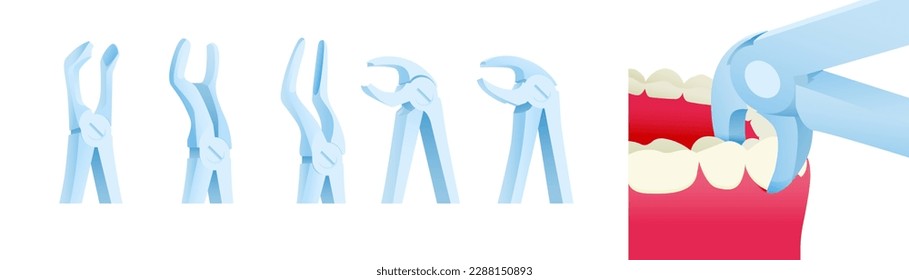 Dental Extracting Forceps Set. Cropped White Teeth with Extracting Forceps Close Up. Modern Flat Vector Illustration.