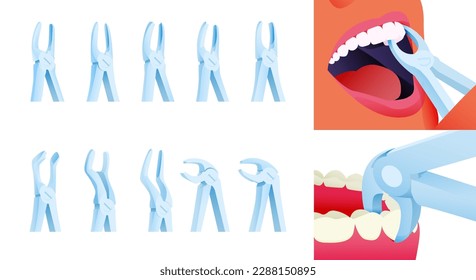 Dental Extracting Forceps Set. Cropped Beautiful Female Face White Teeth with Extracting Forceps Close Up Set. Modern Flat Vector Illustration.