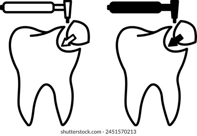 Dental Filling icons. Black and White Vector Icons. Restoration of a Destroyed Tooth with a Composite Filling. Dental care and treatment. Medicine and Dentistry Concept