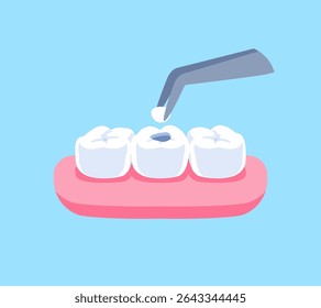 Recheio dentário com design de vetor de ilustração de pinça dentária. Conceito de tratamento dentário.