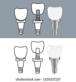 Dental human implant. Healthy teeth and dental implant
