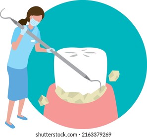 Dental hygienist to remove and clean tartar