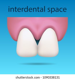 Dental illustration showing interdental space between teeth on the blue background. Aesthetic dentistry. Vector 10 EPS. 