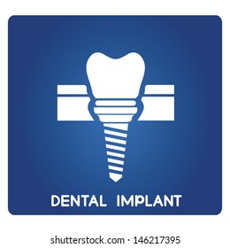 Dental Implant