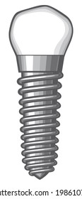 dental implant