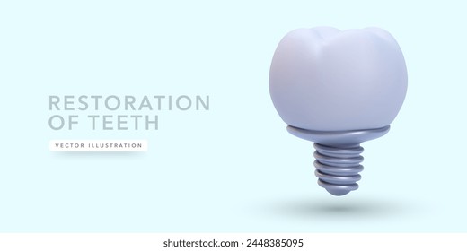 Dental implant in 3d realistic style isolated on light background. Vector illustration