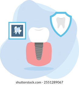 Implante dental o concepto de raíz de diente protésico artificial, reemplazar dientes atornillados de titanio simple diseño de ícono de color de Vector, símbolo de odontología, signo de atención médica, ilustración de instrumento de tratamiento dental