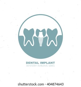 Dental implant between two healthy teeth. Vector  image.  All objects are conveniently grouped  and are easily editable.