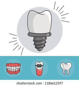 Dental implant care