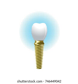 dental implant in color-vector drawing
