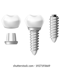 Dental implant component parts, tooth denture components, vector