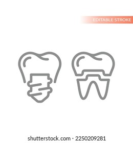 Dental implant and crown line vector icon. Tooth implantology outline symbol.