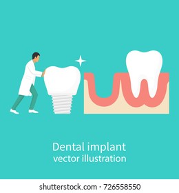 Dental implant. Dentist holding in hand of dentures. Medical equipment. Tooth treatment. Vector illustration flat design. Isolated on background. Stomatology concept.
