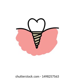 dental implant doodle icon, vector illustration