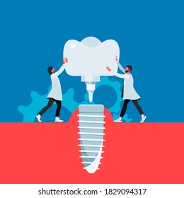 Dental implant flat cartoon illustration. Orthodontic banner design. Prostetic tooth background. Stomatology concept.