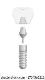 Dental implant flat vector illustration