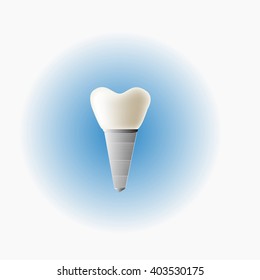 Dental Implant and health tooth, healthy implant with blue background, vector illustration.